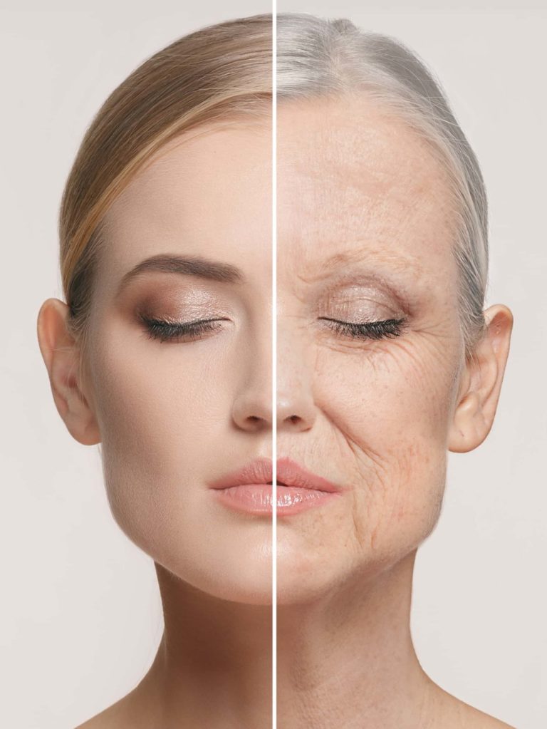Skin Rejuvenation
