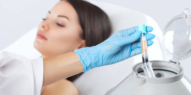 Best Lasting Impact of PRP