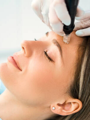 Best microneedling services