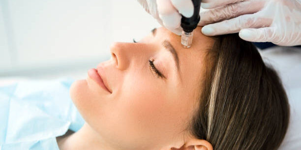 Best microneedling services