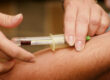 Can I Lay Down After Botox?