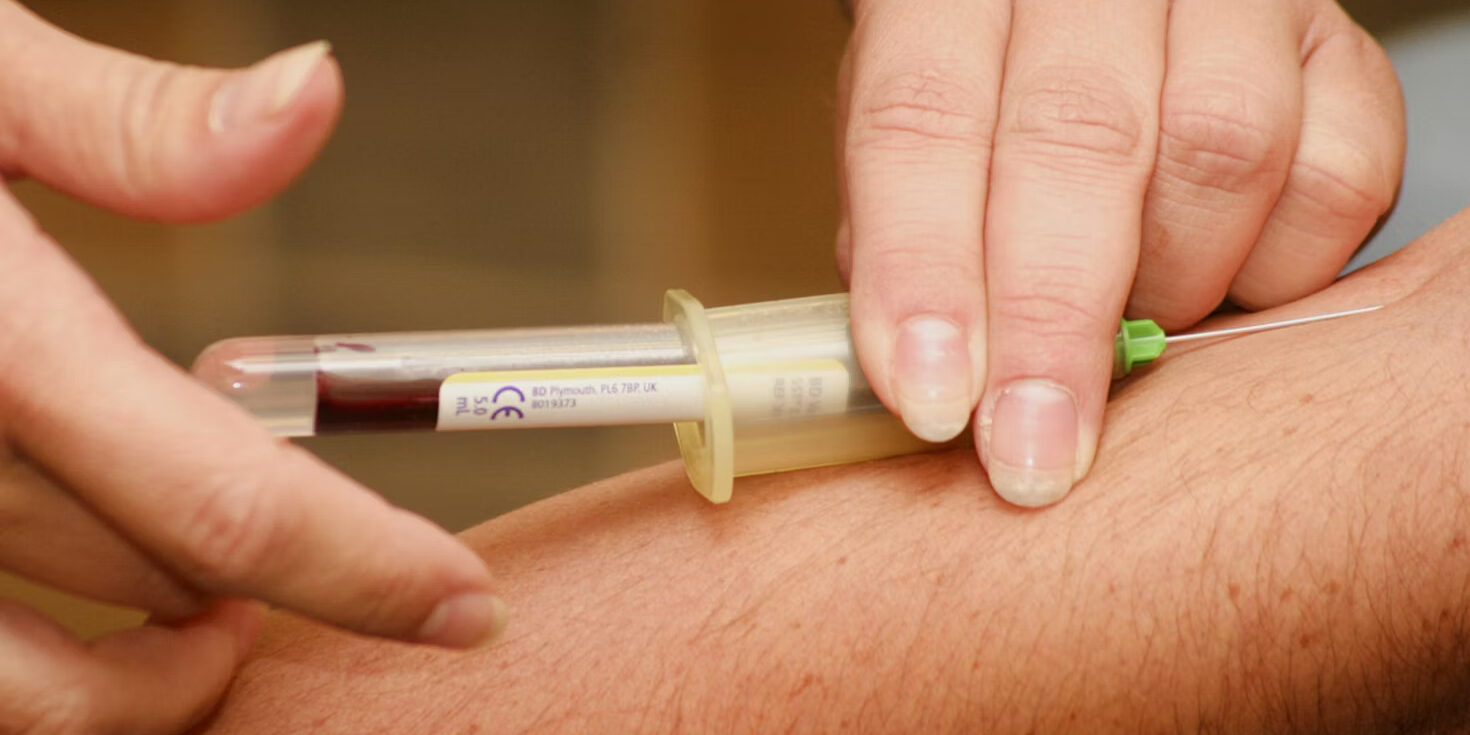Can I Lay Down After Botox?