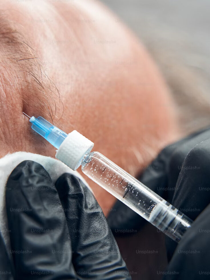 Can You Drink After Botox?