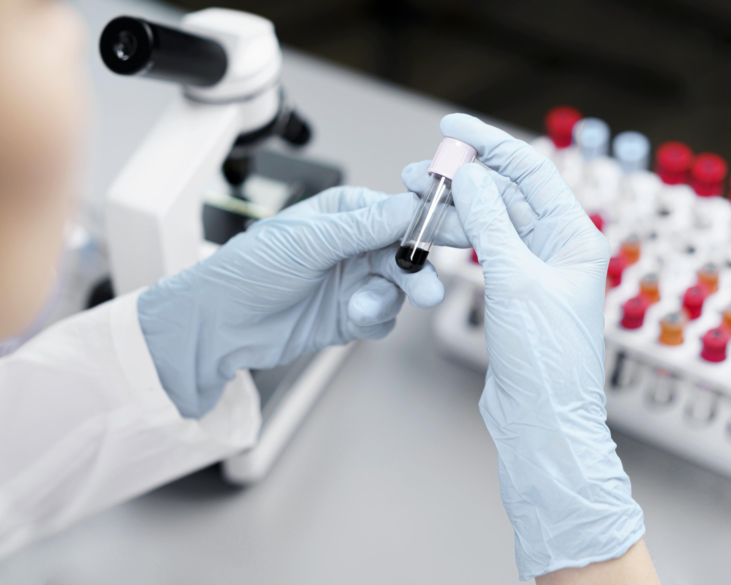 female-hormone-imbalances