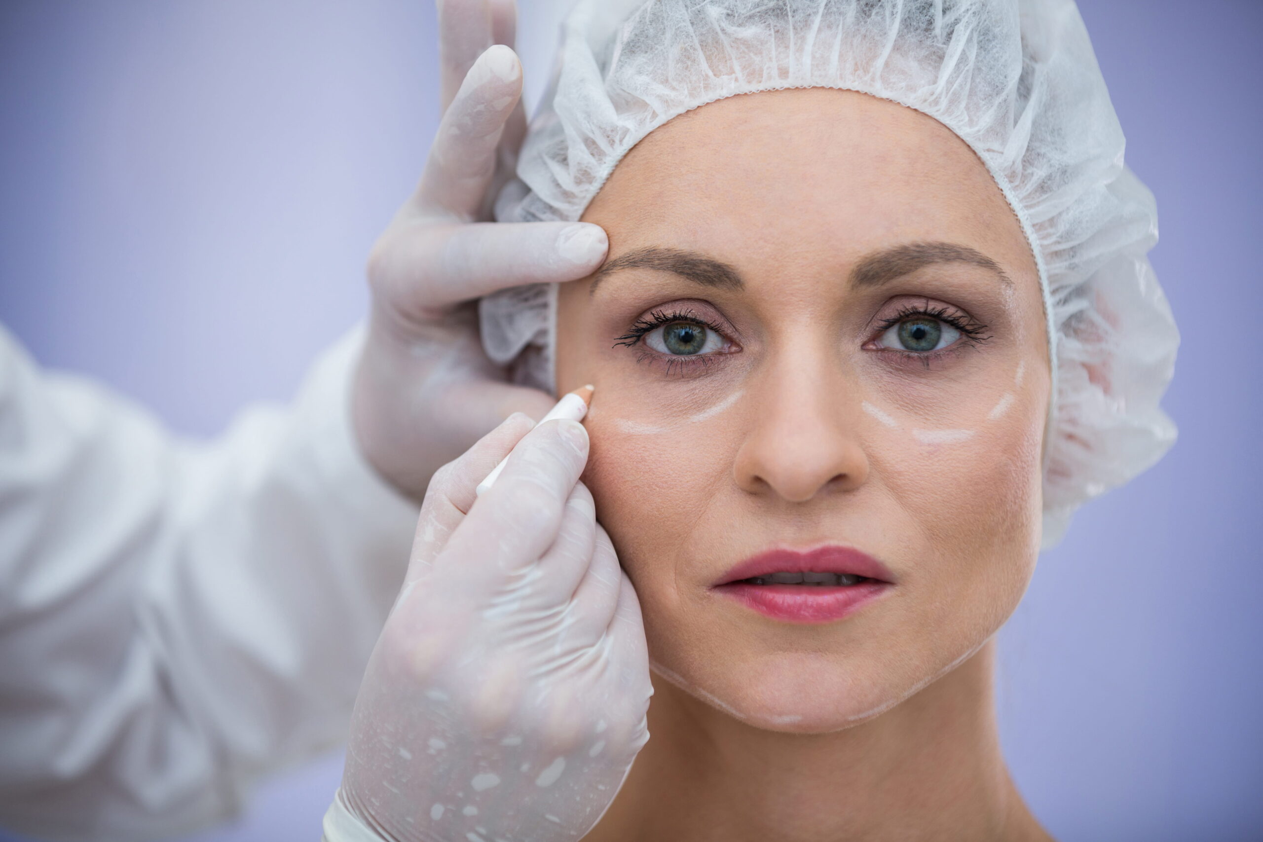 PRP-for-under-eye-rejuvenation
