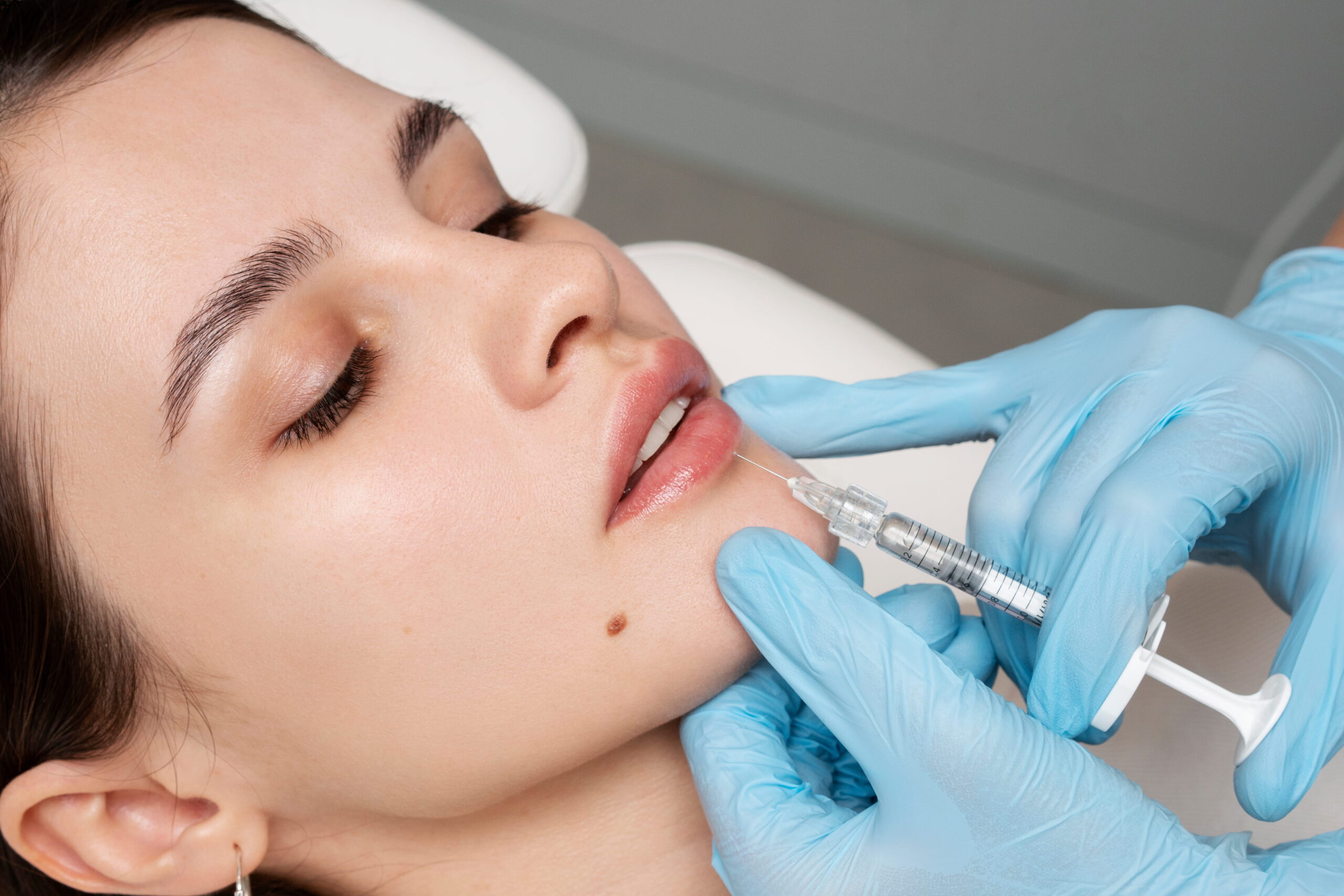 different-types-of-dermal-fillers