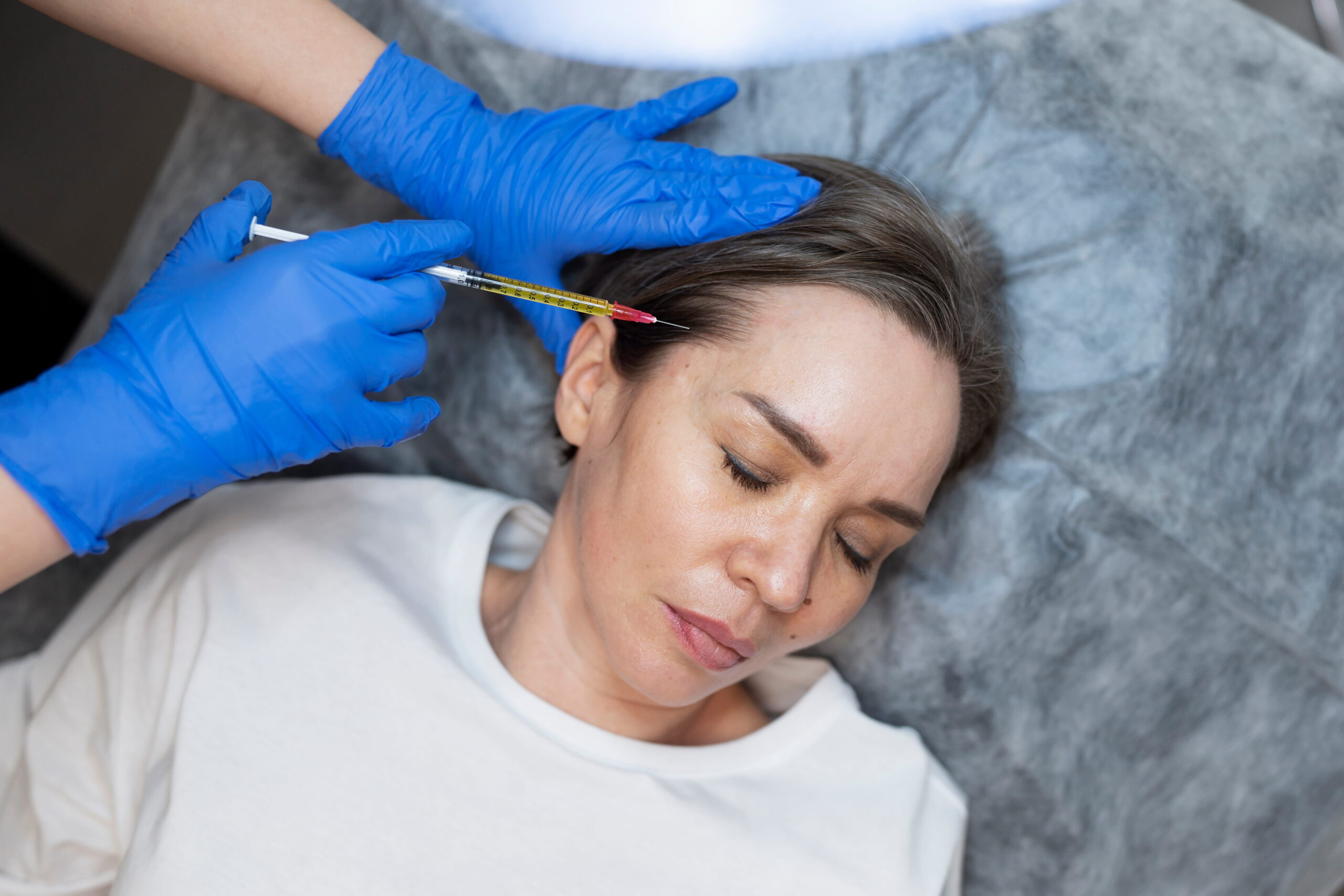 hair-regrowth-PRP-therapy